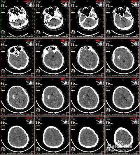 去医院做CT、磁共振等影像学检查为什么要那么久出报告