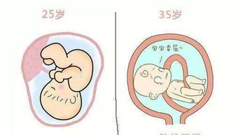 25岁和35岁时的卵泡生育宝宝会一样的吗？