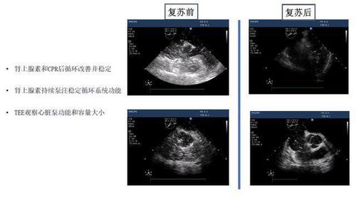 超声专业自我介绍范文,超声心动图如何学习？