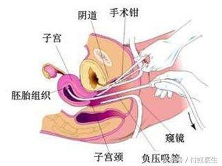 孕吐越严重,孩子就越聪明,这是真的吗 