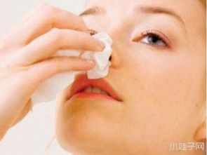 孕妇流鼻血是怎么回事(孕妇流鼻血的原因和预防方法)