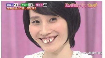 香港医美 日本女明星那么漂亮,为什么大多都没有一口好牙 