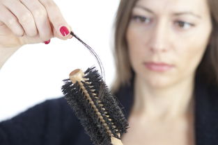 头发油得快的原因 头发老是出油，是湿气比较重吗？ 