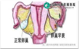 女性如果患卵巢早衰的话还能怀孕吗