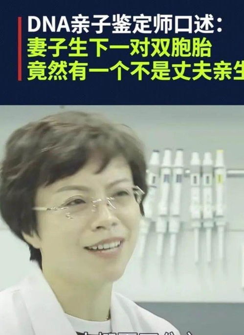 双胞胎看着是两个孩子,实际却有四种类型,不同类型决定不同命运