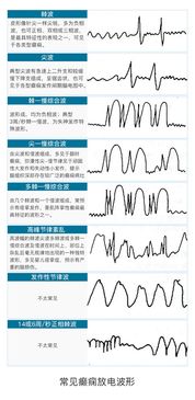 脑电图科室待遇怎么样啊