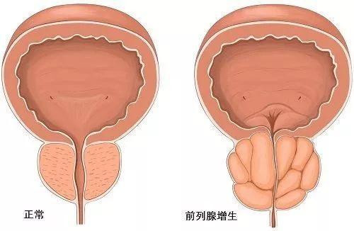 男科医生解读男性身体的健康秘密 女生最好也知道