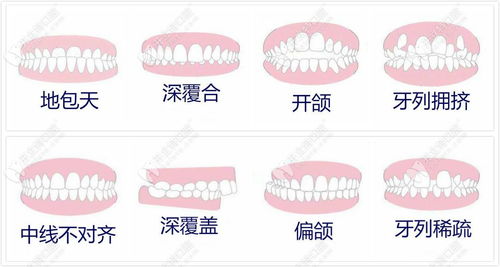 口腔资讯频道 牙科新闻资讯 开立特口腔 