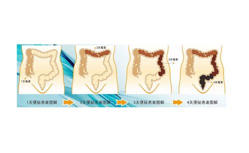 什么病易转化为 癌症 常见的有五种病,你知道几个