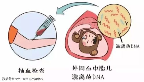 【产前筛查】“无创胎儿DNA检测”or “羊水穿刺”该如何选择