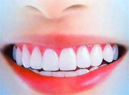 刷牙前只需一个小方法,牙黄 口臭都消失,告别口臭 大黄牙