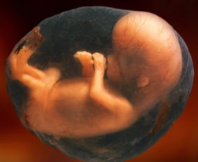 原创胎儿胎动频繁，也可能是这3个原因，尤其最后一个准妈妈要多注意