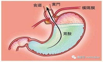 怀孕4种局部疼痛让孕妈妈不敢生二胎,别担心,居家护理有妙招