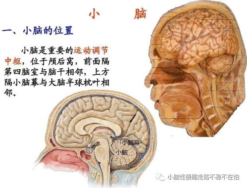 王常在大夫中医辨证小脑萎缩