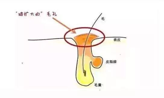 出油是因为缺水 你被骗了多少年 