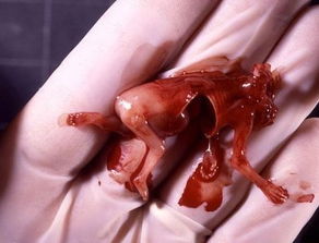 四个月药流的胎儿图片图片