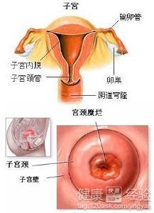 为什么这个月月经量很少，以前都超级多的。量少和宫颈糜烂有关嘛？