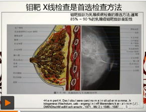 青年女性乳腺癌外科诊治特点