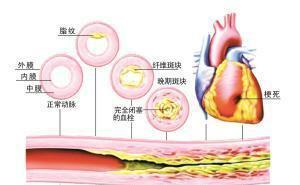 脸上 出现4种表现,可能是血脂高了 降血脂,4样食物少吃