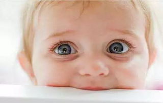 宝宝整天眨眼眨个不停 小心是不是这几种小儿疾病 