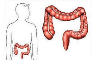 结肠癌最有价值的检查有哪些 