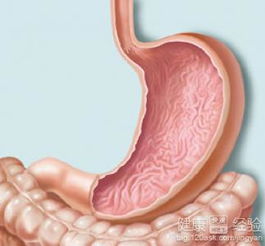 萎缩性胃炎跟局部肠化应注意什么