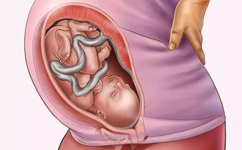 胎儿心脏问题专家建议(怀孕七个月胎儿心脏室间隔穿隔血流怎么回事)