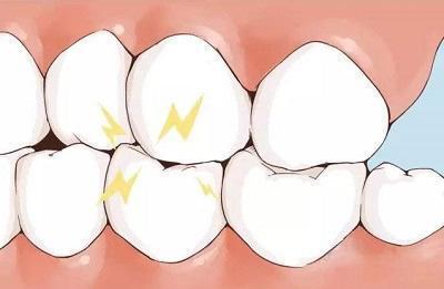 肝内有疾,牙齿先知 若牙齿若出现3种异常,或许是肝在 求救