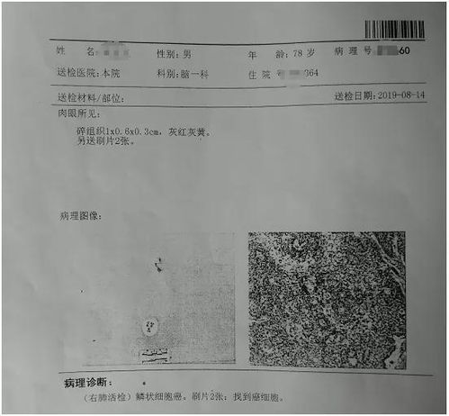 肺癌晚期患者要不要做放化疗