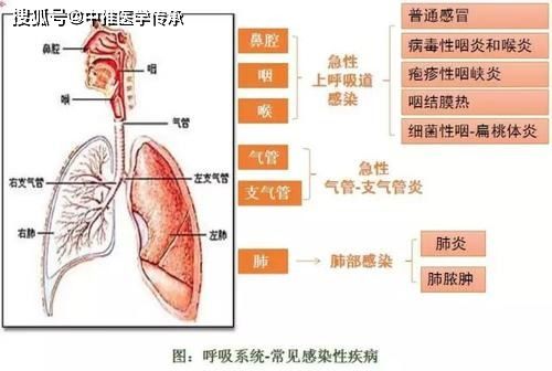 治急性上呼吸道感染秘方 方 6 首