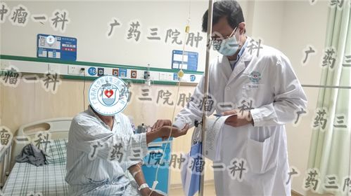 肺癌胸腔积液是晚期吗 广东肿瘤医院