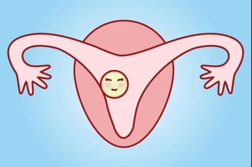 在试管胚胎移植后侧躺会发生宫外孕吗？