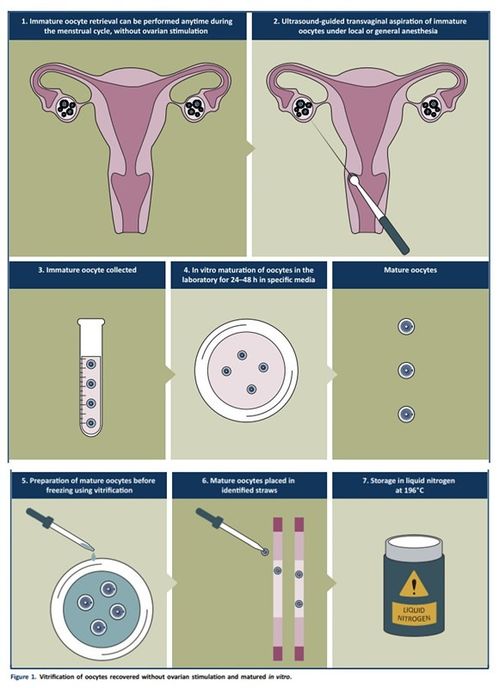 体外养卵(体外养卵的体外养卵技术及过程)