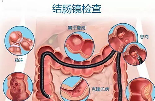 做完肠镜拉大便有血是怎么回事(做肠镜后大便有血怎么回事)