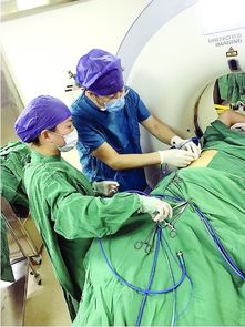 建阳第一医院成功开展肝癌微波消融术 