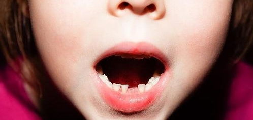 孩子从几岁开始换牙才正常呢 过早和过晚有什么区别呢