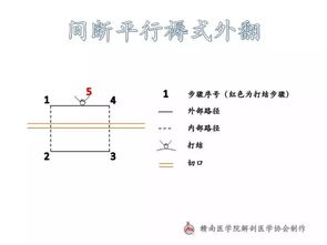 图解 常用外科缝合路径示意图