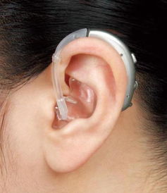 杭州滨江助听器 单 双耳佩戴助听器对助听效果的影响 