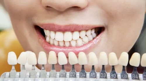 牙齿发黑暗示身体疾病 这10个因素千万别忽视 