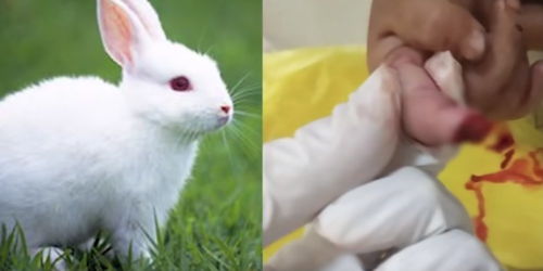 兔子急了也咬人 陕西1岁多女孩被咬断手指 被兔子咬了该怎么办