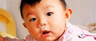 10个月宝宝老是流清鼻涕吃药也不管用，怎么办