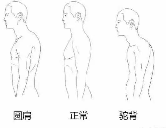 导致你变丑的可能是圆肩的体态,如何判断并矫正圆肩 