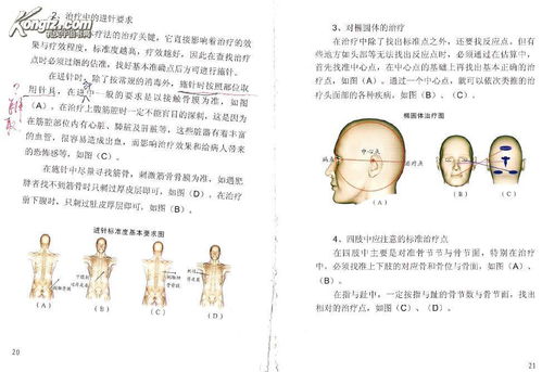 中国新针刺 八字治疗法 李柏松博士独创治疗法,内含万宝功能汤二十四种加减方 下单前注意看描述