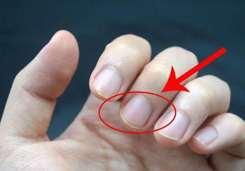 手指上的月牙 手指甲上的白色月牙到底代表着什么意思