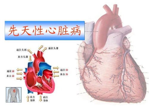 先天性心脏病和什么因素有关系