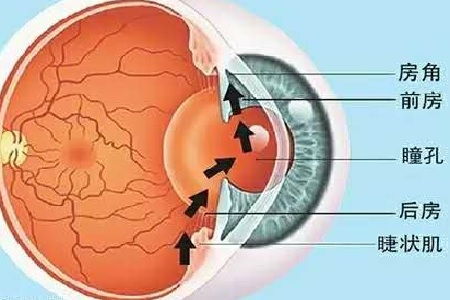 眼压高是什么原因导致的(眼压高是什么原因导致的?)