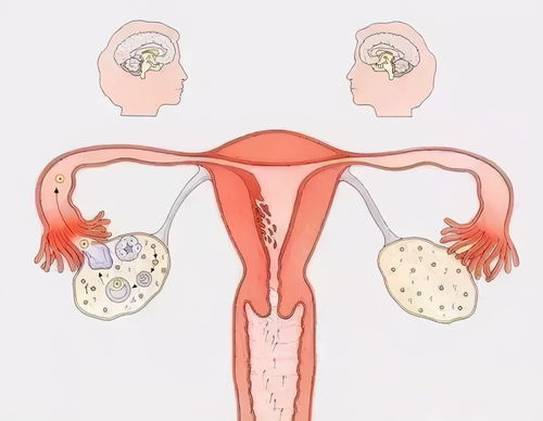 有肌瘤还能怀孕吗 怀孕之后查出子宫肌瘤怎么办