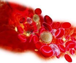 血小板减少与原发性血小板增多区别是什么 