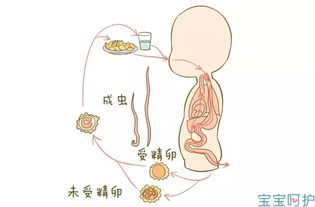 吃不胖 眼白有青影,是不是宝宝肚子里有虫子 