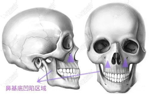 鼻基底用大分子还是小分子